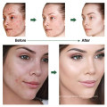OEM Custom Herbal Acne Scar Removal Brightening Cream
